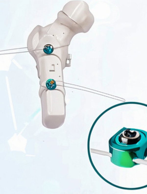 POLYMER CERCLAGE CABLE